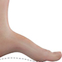 Cavovarus Foot Correction